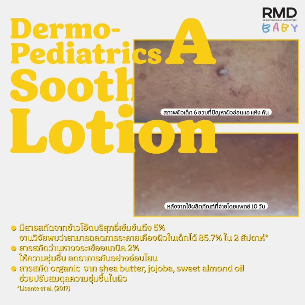 Dermo-Pediatrics A Soothing Lotion รูปที่ 2