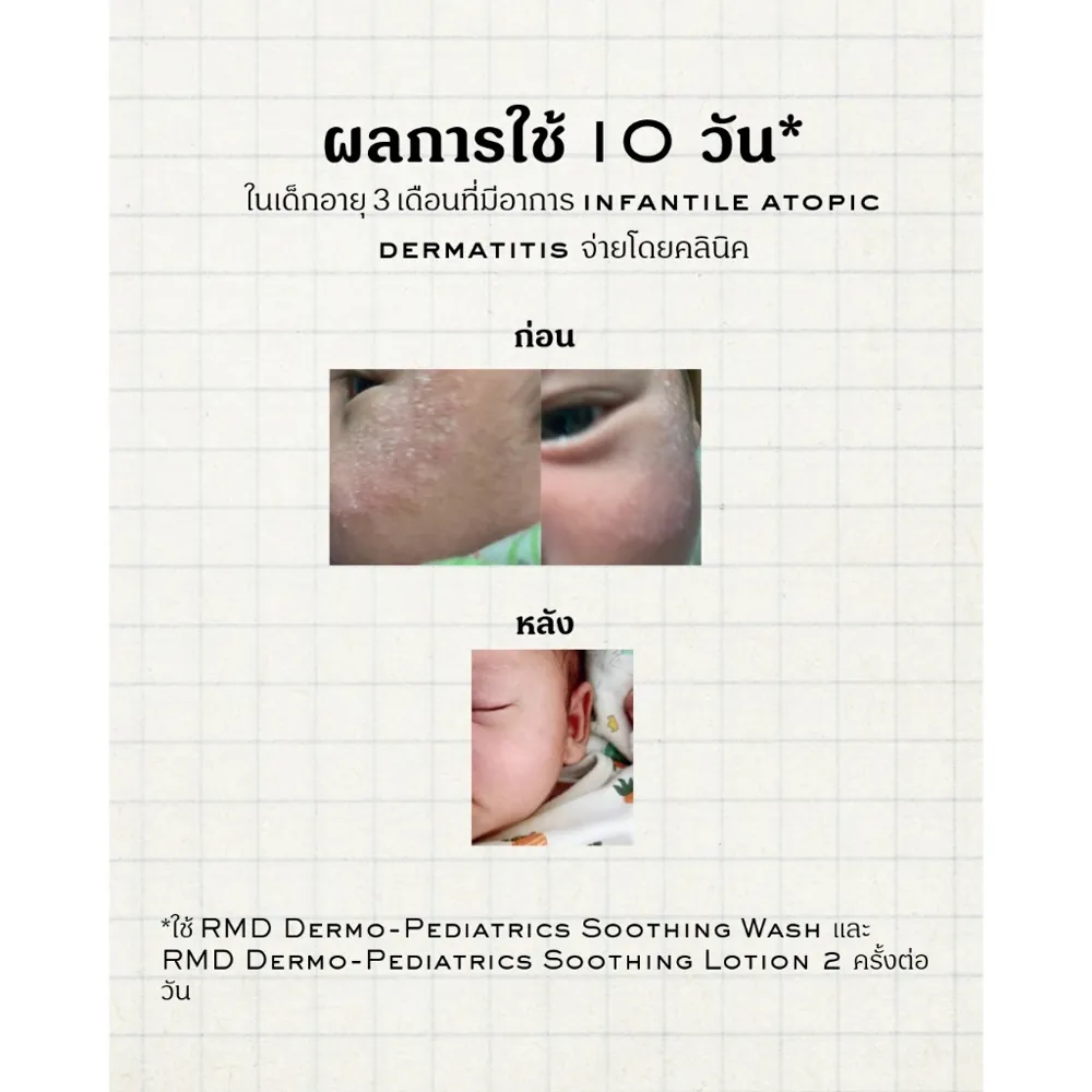 Dermo-Pediatrics A Soothing Lotion รูปที่ 3