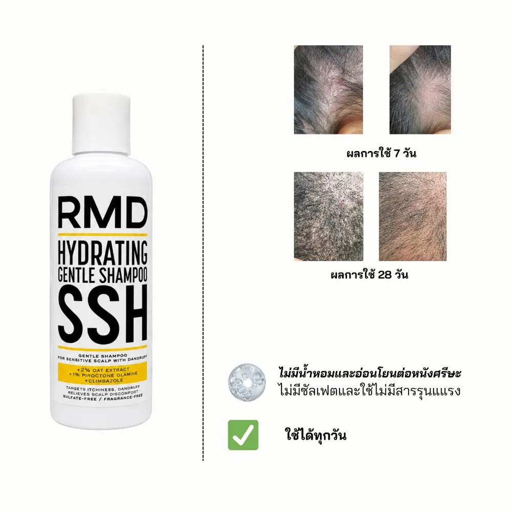 Seb Control Daily Shampoo SSH รูปที่ 4